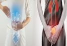 An In-Depth Guide To Bladder Pain